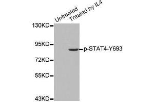 Western blot analysis of extracts from HepG2 cells using Phospho-STAT4-Y693 antibody (ABIN2987407). (STAT4 anticorps  (pTyr693))