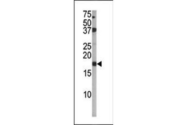 CDKN2A anticorps  (pSer140)