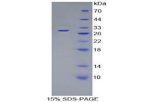SDS-PAGE (SDS) image for Coagulation Factor XI (F11) (AA 170-398) protein (His tag) (ABIN1879846) (Factor XI Protein (AA 170-398) (His tag))