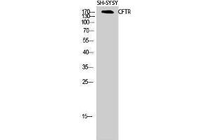 Western Blotting (WB) image for anti-Cystic Fibrosis Transmembrane Conductance Regulator (ATP-Binding Cassette Sub-Family C, Member 7) (CFTR) (Ser246) antibody (ABIN3179947) (CFTR anticorps  (Ser246))