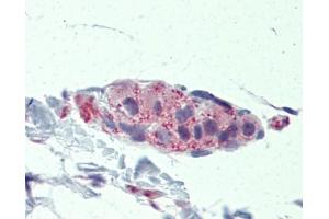 TNKS antibody was used for immunohistochemistry at a concentration of 4-8 ug/ml. (TNKS anticorps  (Middle Region))