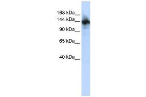 RBM6 antibody used at 2. (RBM6 anticorps  (N-Term))