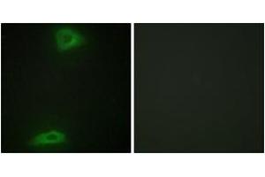 Immunofluorescence analysis of HepG2 cells, using ERGI3 Antibody. (ERGIC3 anticorps  (AA 321-370))