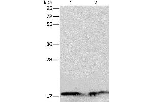Western blot analysis of Human normal liver and fetal liver tissue, using ANG Polyclonal Antibody at dilution of 1:133 (ANG anticorps)