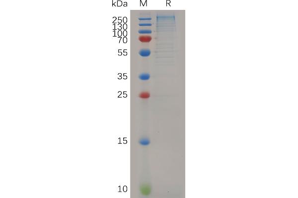 LAMa4 Protein (AA 25-1816) (His tag)