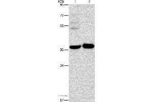 Western blot analysis of A172 cell and human fetal brain tissue, using SERPINE2 Polyclonal Antibody at dilution of 1:450 (SERPINE2 anticorps)