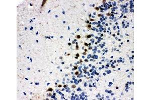 IHC-P: MYBL2 antibody testing of rat brain tissue (MYBL2 anticorps  (N-Term))