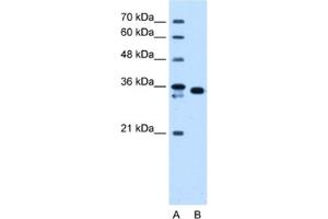 Western Blotting (WB) image for anti-Aldo-Keto Reductase Family 1, Member B1 (Aldose Reductase) (AKR1B1) antibody (ABIN2463149) (AKR1B1 anticorps)