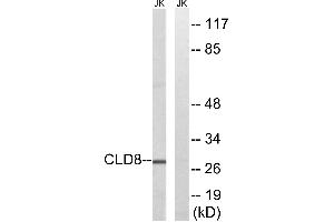 Western blot analysis of extracts from Jurkat cells, using CLDN8 antibody. (CLDN8 anticorps)