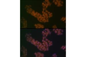 Immunofluorescence analysis of HeLa cells using B Rabbit mAb (ABIN7265826) at dilution of 1:100 (40x lens). (BANF1 anticorps)