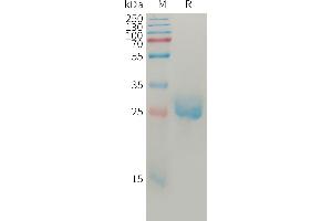 Human AN(275-496) Protein, His Tag on SDS-PAGE under reducing condition. (Angiopoietin 2 Protein (ANGPT2) (AA 275-496) (His tag))