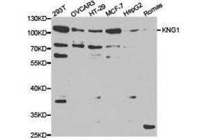 Western Blotting (WB) image for anti-Kininogen 1 (KNG1) antibody (ABIN1873454) (KNG1 anticorps)
