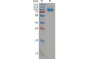 Human CD26 Protein, His Tag on SDS-PAGE under reducing condition. (DPP4 Protein (AA 34-766) (His tag))