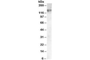 Western blot testing of A549 lysate with ABCC1 antibody at 0. (ABCC1 anticorps)