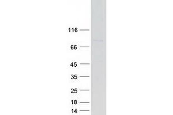 PIGQ Protein (Transcript Variant 1) (Myc-DYKDDDDK Tag)