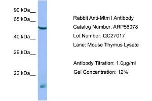 Western Blotting (WB) image for anti-Myotubularin 1 (MTM1) (N-Term) antibody (ABIN971203) (MTM1 anticorps  (N-Term))
