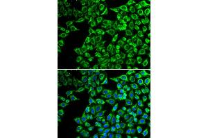 Immunofluorescence analysis of A549 cells using LIPC antibody. (LIPC anticorps)