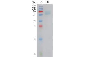 Cynomolgus AXL Protein, His Tag on SDS-PAGE under reducing condition. (AXL Protein (AA 33-449) (His tag))
