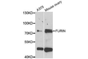 Western blot analysis of extracts of A375 and mouse ovary cell lines, using FURIN antibody. (FURIN anticorps)