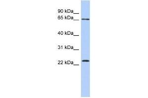 ZNF428 antibody used at 0. (ZNF428 anticorps  (N-Term))