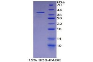 SDS-PAGE analysis of Mouse ENO2 Protein. (ENO2/NSE Protéine)