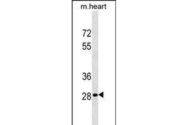 HOXB13 anticorps  (C-Term)