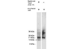 Western blot of endogenous Trag3 present in Jurkat cell lysate (10 ug/lane) using X1872P (0. (CSAG2 anticorps)