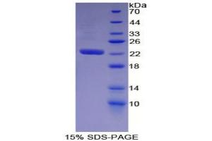 SDS-PAGE analysis of Mouse WARS Protein. (WARS Protéine)