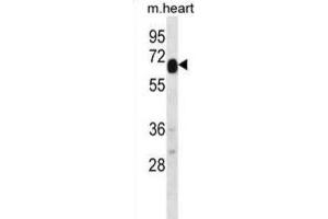 Western Blotting (WB) image for anti-Recombination Activating Gene 2 (RAG2) antibody (ABIN2996750) (RAG2 anticorps)