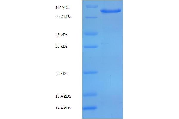 CCDC36 Protein (AA 11-592, partial) (His-SUMO Tag)