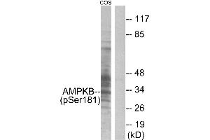 Immunohistochemistry analysis of paraffin-embedded human skeletal muscle tissue, using AMPK β1 (Phospho-Ser181) antibody. (PRKAB1 anticorps  (pSer181))
