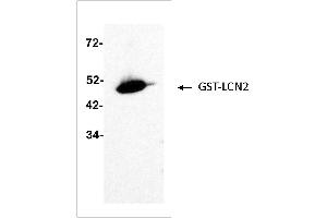 Antigen: GST-LCN2 (ABIN2703637) full length recombinant protein 2 ng  Primary Antibody: Anti-LCN2 monoclonal (PA348-26. (Lipocalin 2 anticorps)