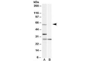 Western blot testing of HeLa cell lysate with PRPF31 antibody at 1ug/ml with [B] and without [A] blocking/immunizing peptide. (PRPF31 anticorps)