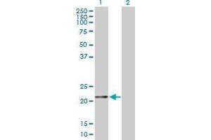 Western Blot analysis of FTH1 expression in transfected 293T cell line by FTH1 MaxPab polyclonal antibody. (FTH1 anticorps  (AA 1-183))