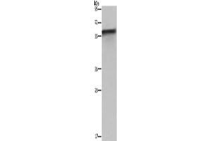 Western Blotting (WB) image for anti-FK506 Binding Protein 8, 38kDa (FKBP8) antibody (ABIN2430123) (FKBP8 anticorps)