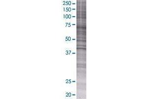 RAG1AP1 transfected lysate. (RAG1AP1 293T Cell Transient Overexpression Lysate(Denatured))