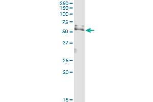 Immunoprecipitation of USP3 transfected lysate using rabbit polyclonal anti-USP3 and Protein A Magnetic Bead (USP3 (Humain) IP-WB Antibody Pair)