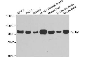 Western blot analysis of extracts of various cell lines, using GPD2 antibody (ABIN5973974) at 1/1000 dilution. (GPD2 anticorps)