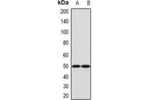 Western blot analysis of Ephrin B2 expression in mouse lung (A), mouse brain (B) whole cell lysates. (Ephrin B2 anticorps)