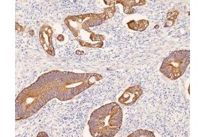 Immunohistochemistry (IHC) image for anti-Keratin 8 (KRT8) (C-Term) antibody (ABIN870549) (KRT8 anticorps  (C-Term))