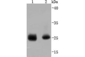 Lane 1: Human heart, Lane 2: Human skeletal muscle lysate probed with PI 3 Kinase p85 alpha (2G4) Monoclonal Antibody  at 1:1000 overnight at 4˚C. (HSP27 anticorps  (pSer78))