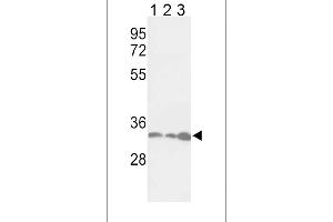 Western blot analysis of PCNA Antibody in Jurkat(lane 1), Hela(lane 2), 293(lane 3) cell line lysates (35ug/lane) (PCNA anticorps  (AA 89-117))