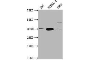 Western Blot Positive WB detected in: U87 whole cell lysate, NTERA-2 whole cell lysate, K562 whole cell lysate All lanes: CBY1 antibody at 1:2000 Secondary Goat polyclonal to rabbit IgG at 1/50000 dilution Predicted band size: 15 kDa Observed band size: 35 kDa (CBY1/PGEA1 anticorps  (AA 41-126))