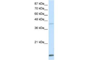 WB Suggested Anti-MKX Antibody Titration:  0. (MKX anticorps  (Middle Region))