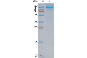 Human L1-Nanodisc, Flag Tag on SDS-PAGE (NPC1L1 Protéine)