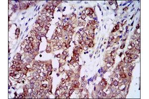 Immunohistochemistry (IHC) image for anti-Heat Shock Protein 90kDa alpha (Cytosolic), Class A Member 1 (HSP90AA1) antibody (ABIN1843961) (HSP90AA1 anticorps)