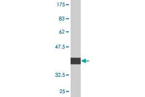 Western Blot detection against Immunogen (37. (TADA2B anticorps  (AA 2-110))