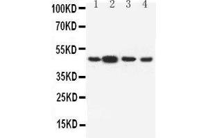 Anti-Dopamine Receptor D3 antibody, Western blotting Lane 1: Rat Testis Tissue Lysate Lane 2: Rat Brain Tissue Lysate Lane 3: U87 Cell Lysate Lane 4: HELA Cell Lysate (DRD3 anticorps  (C-Term))