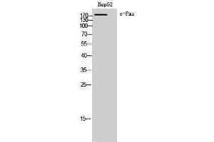 Western Blotting (WB) image for anti-Colony Stimulating Factor 1 Receptor (CSF1R) (Ser275) antibody (ABIN3174363) (CSF1R anticorps  (Ser275))