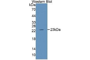 Figure. (Caspase 1 anticorps  (AA 120-297))